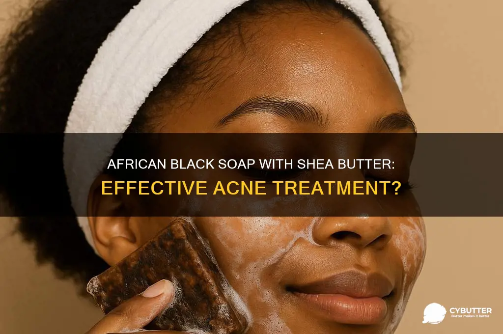 is african black soap with shea butter good for acne