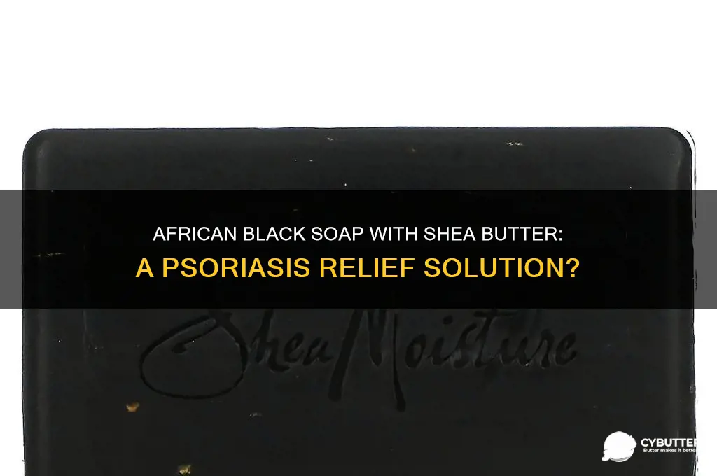 is african black soap with shea butter good for psoriasis
