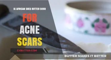 African Shea Butter: Effective Solution for Acne Scars and Skin Repair?