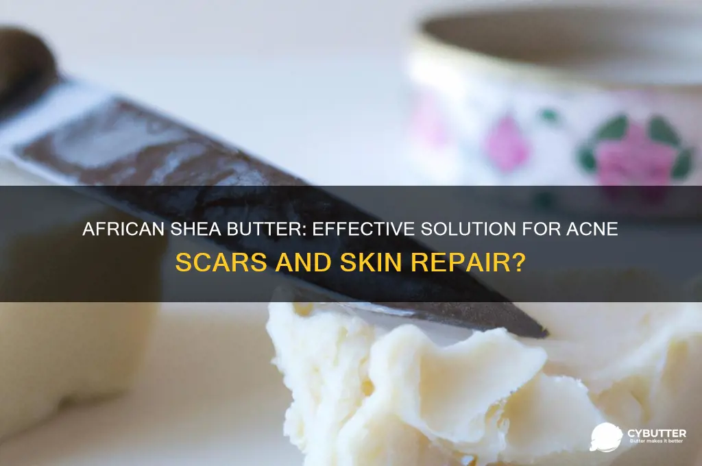 is african shea butter good for acne scars