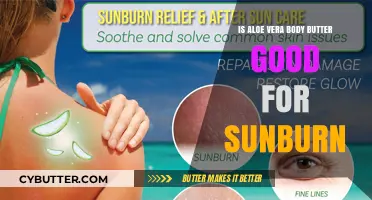 Aloe Vera Body Butter: Effective Sunburn Relief or Just a Myth?