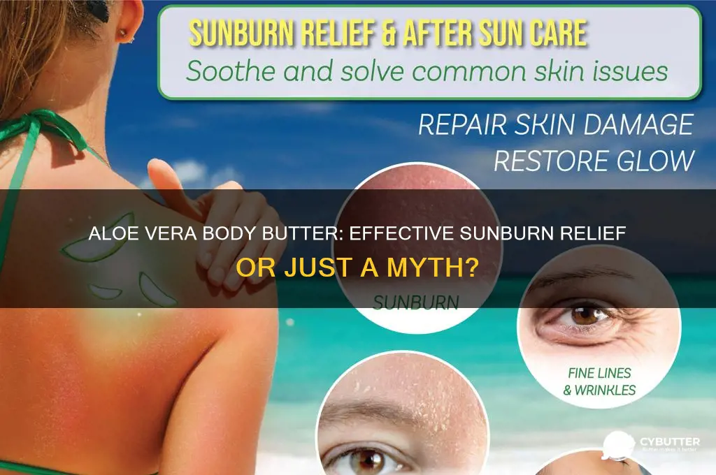 is aloe vera body butter good for sunburn
