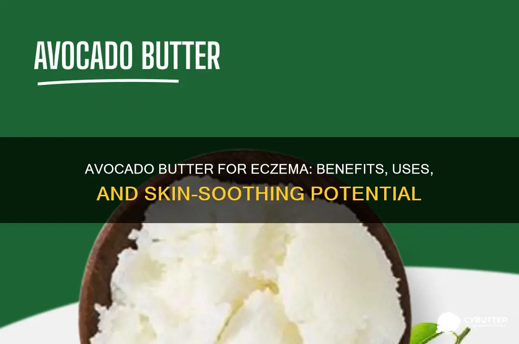 is avocado butter good for eczema
