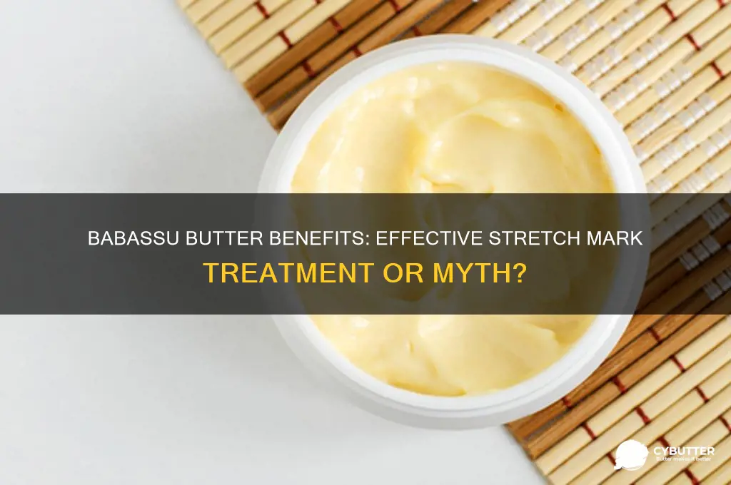 is babassu butter good for stretch marks