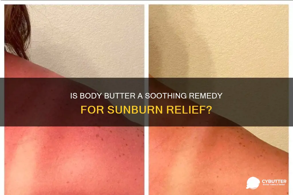 is body butter good for sunburn