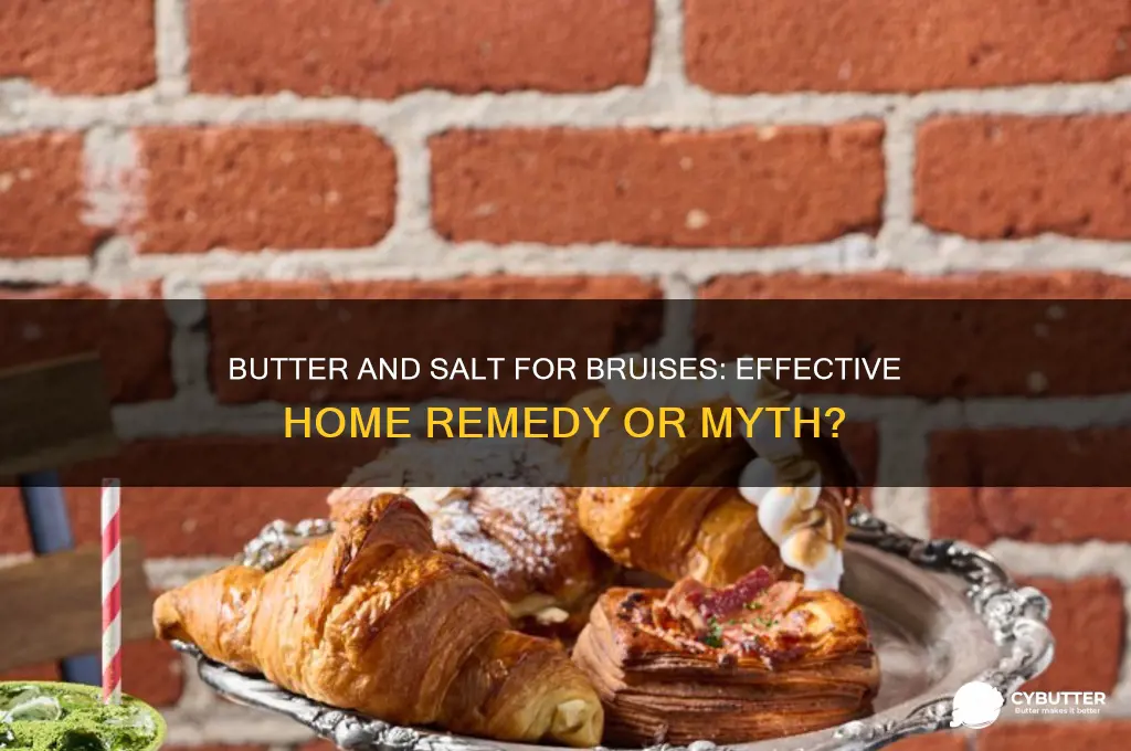 is butter and salt good for bruises