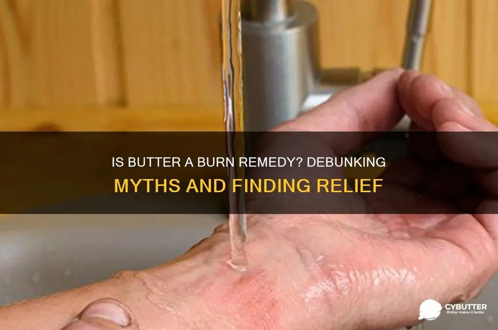 is butter good fir a burn