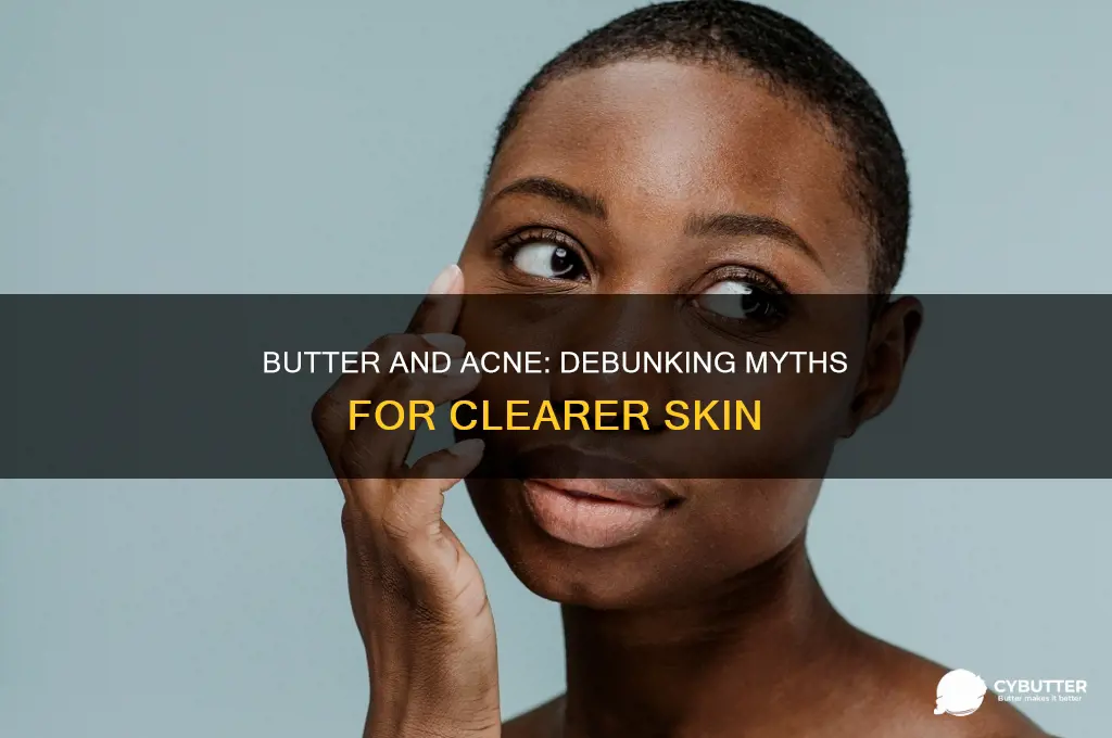 is butter good for acne
