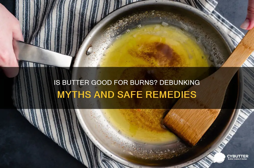 is butter good for burns
