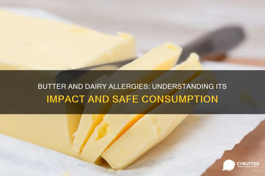 is butter good for dairy allergy