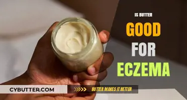 Is Butter a Natural Remedy for Eczema Relief? Find Out