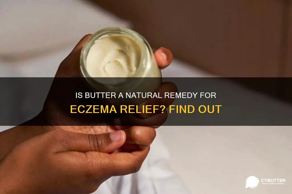 is butter good for eczema