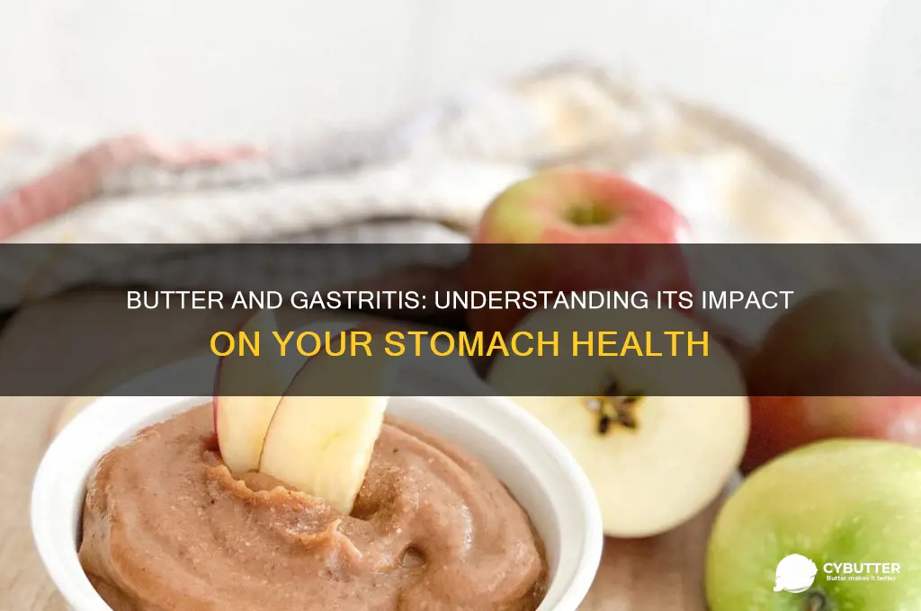 is butter good for gastritis