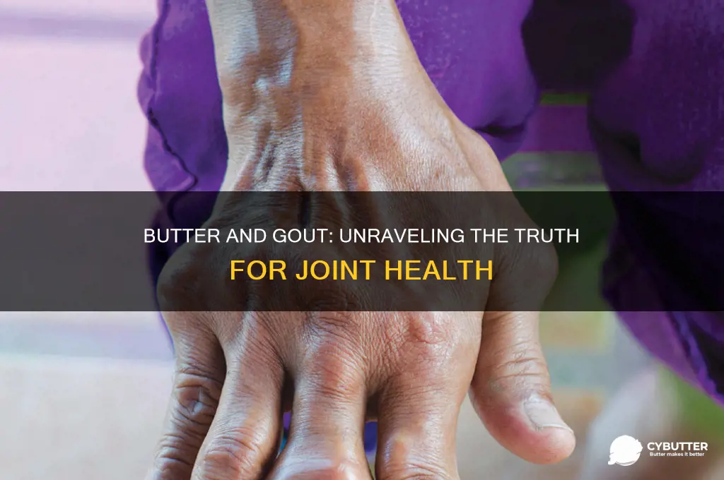 is butter good for gout