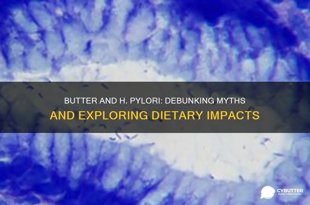 is butter good for h pylori