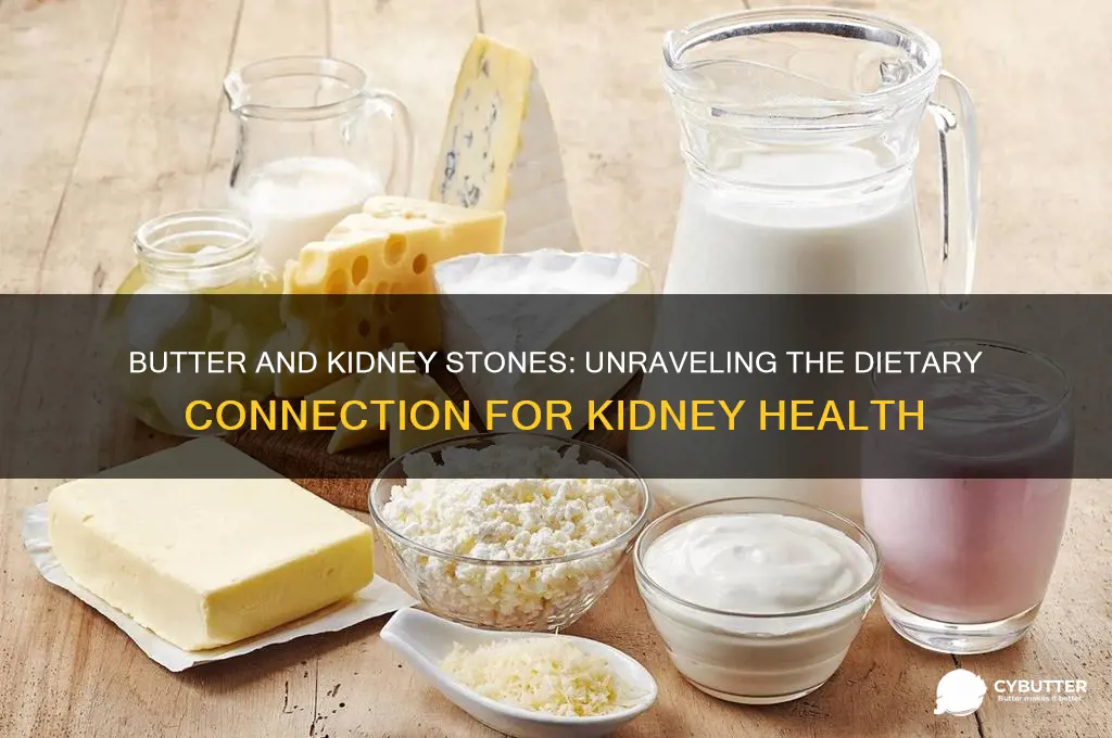 is butter good for kidney stones