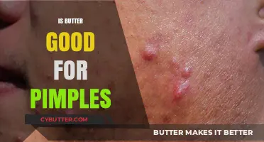 Butter and Pimples: Debunking Myths for Clearer Skin