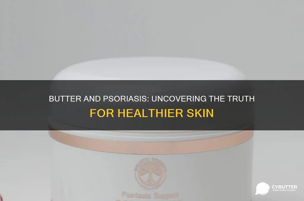 is butter good for psoriasis