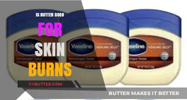 Butter for Skin Burns: Effective Remedy or Harmful Myth?