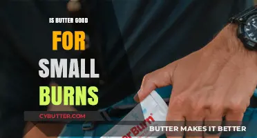 Butter for Burns: Effective Remedy or Harmful Myth?