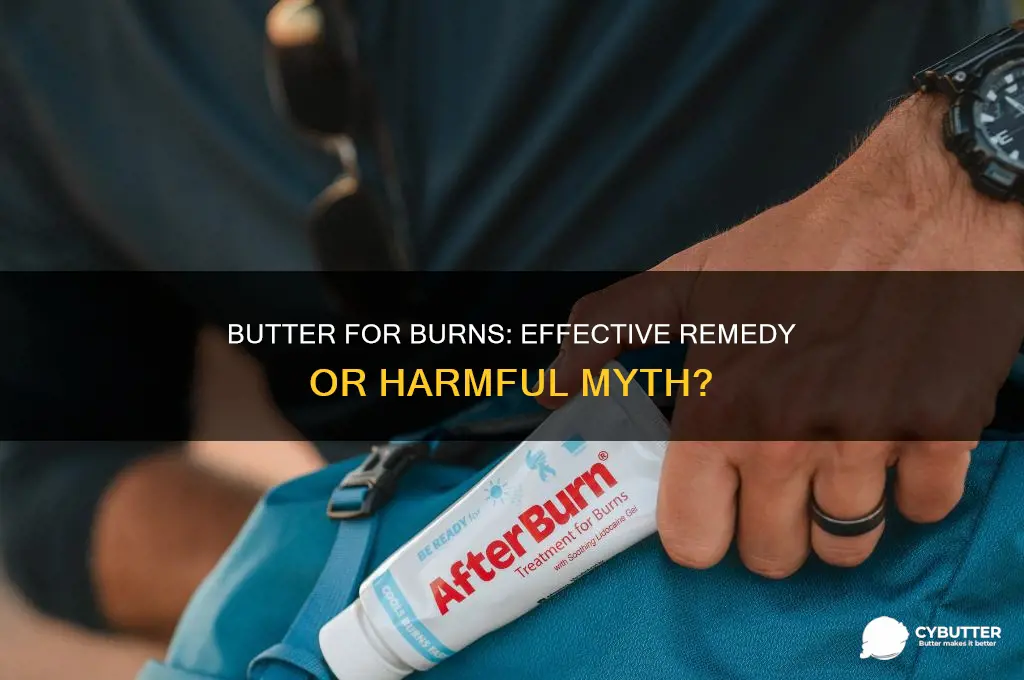 is butter good for small burns