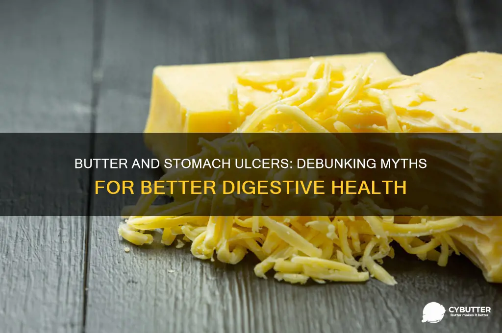 is butter good for stomach ulcers