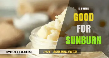 Butter for Sunburn: Myth or Effective Home Remedy?