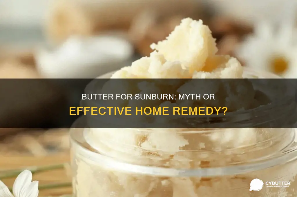 is butter good for sunburn