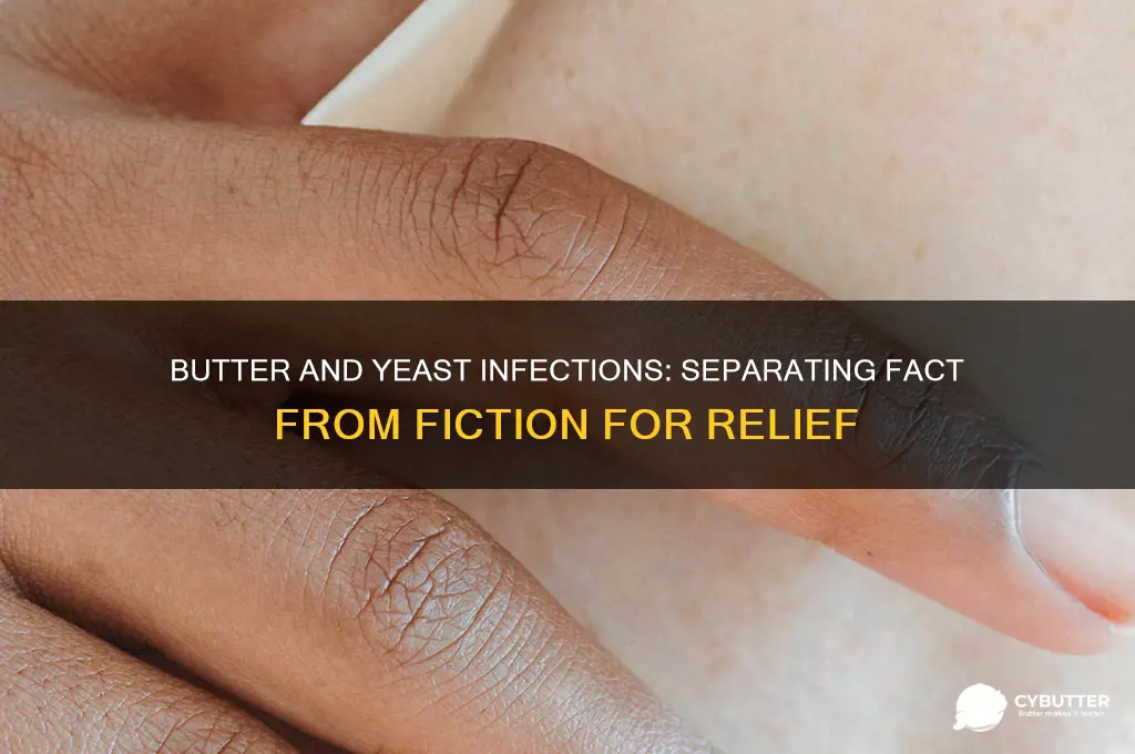is butter good for yeast infections