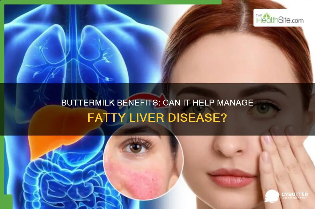 is butter milk good for fatty liver