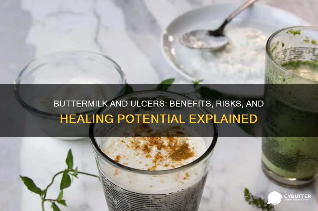 is butter milk good for ulcer