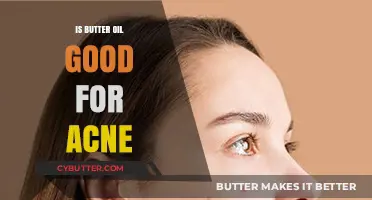 Butter Oil for Acne: Benefits, Risks, and Effective Usage Tips