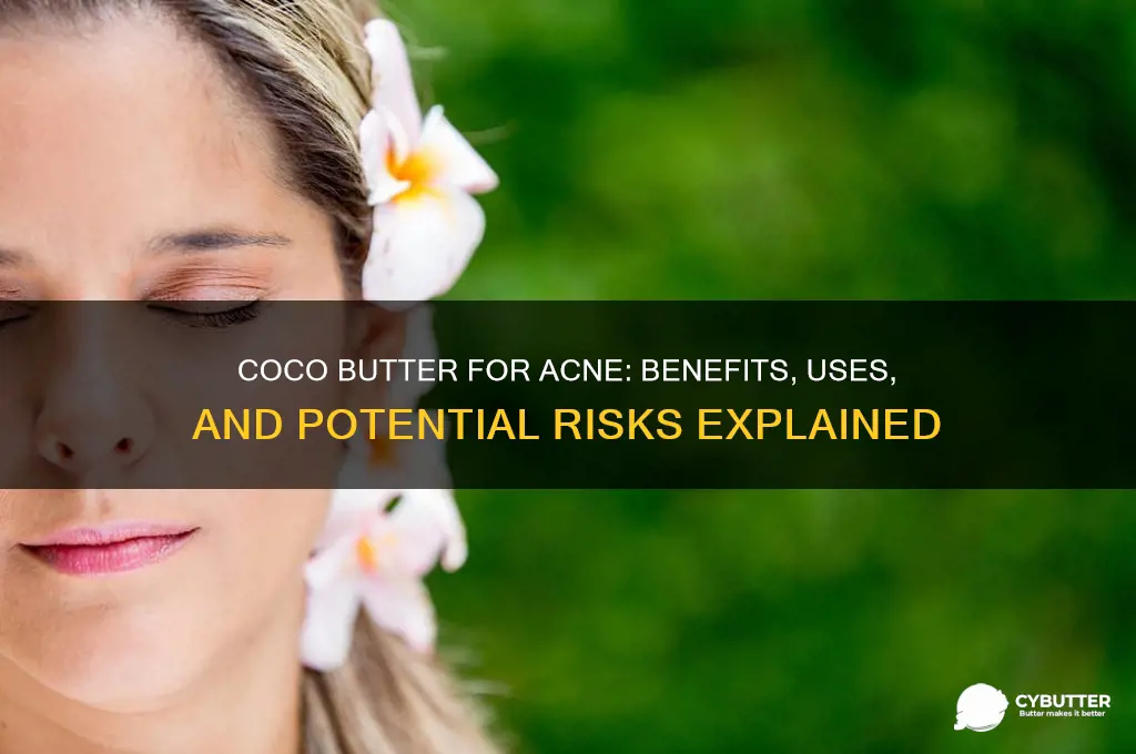 is coco butter good for acne