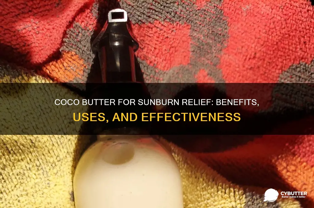 is coco butter good for sun burn