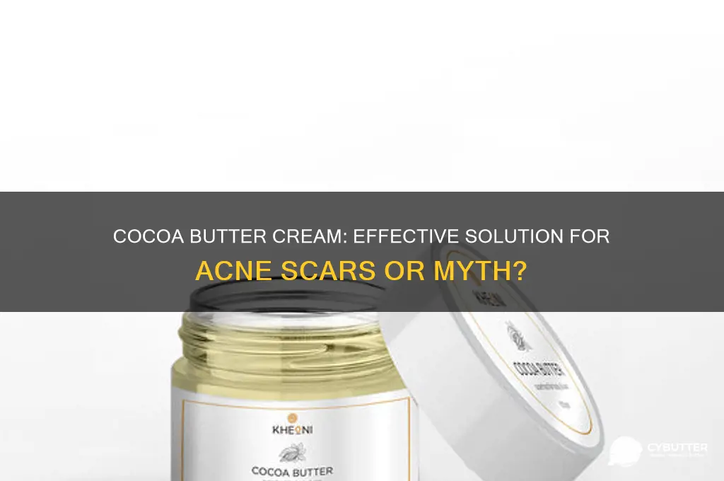 is cocoa butter cream good for acne scars