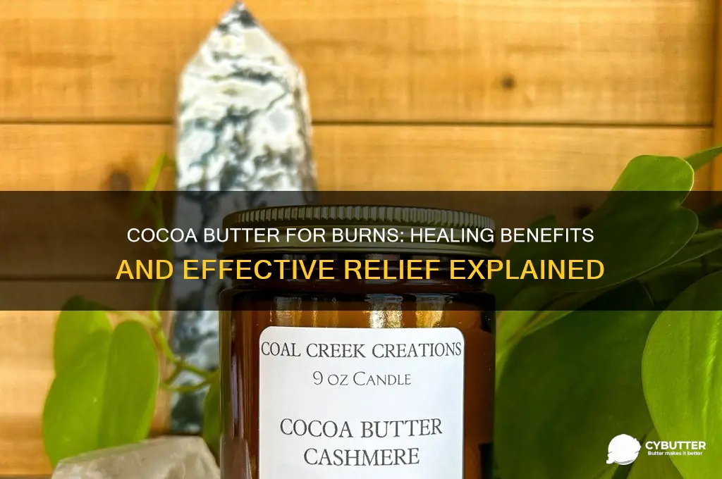 is cocoa butter good for a burn
