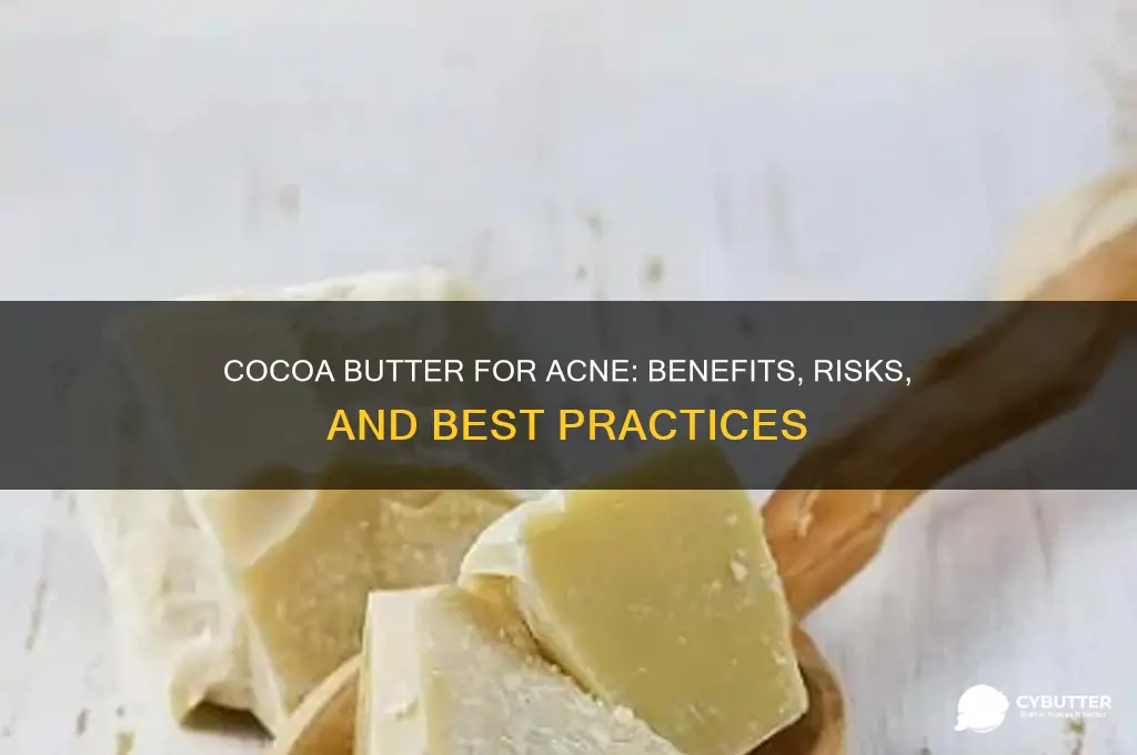 is cocoa butter good for acne prone skin