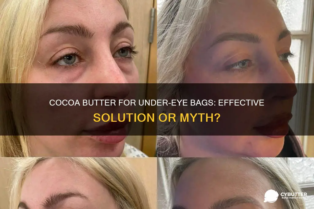 is cocoa butter good for bags under eyes