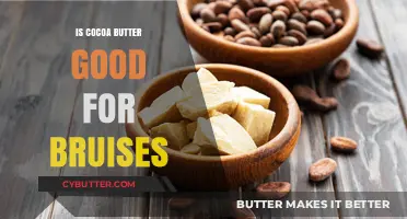 Cocoa Butter for Bruises: Healing Benefits and How to Use It