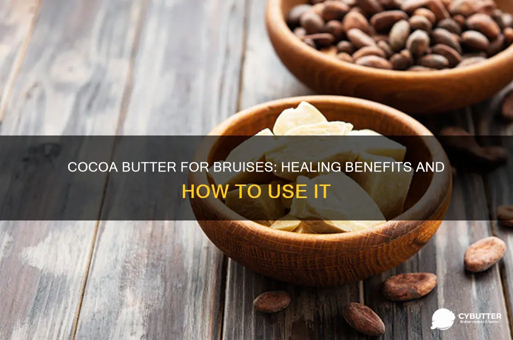 is cocoa butter good for bruises