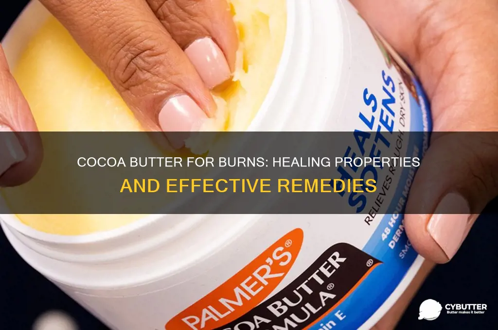is cocoa butter good for burns