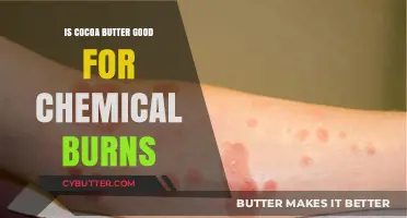 Cocoa Butter's Healing Potential for Chemical Burns: What You Need to Know