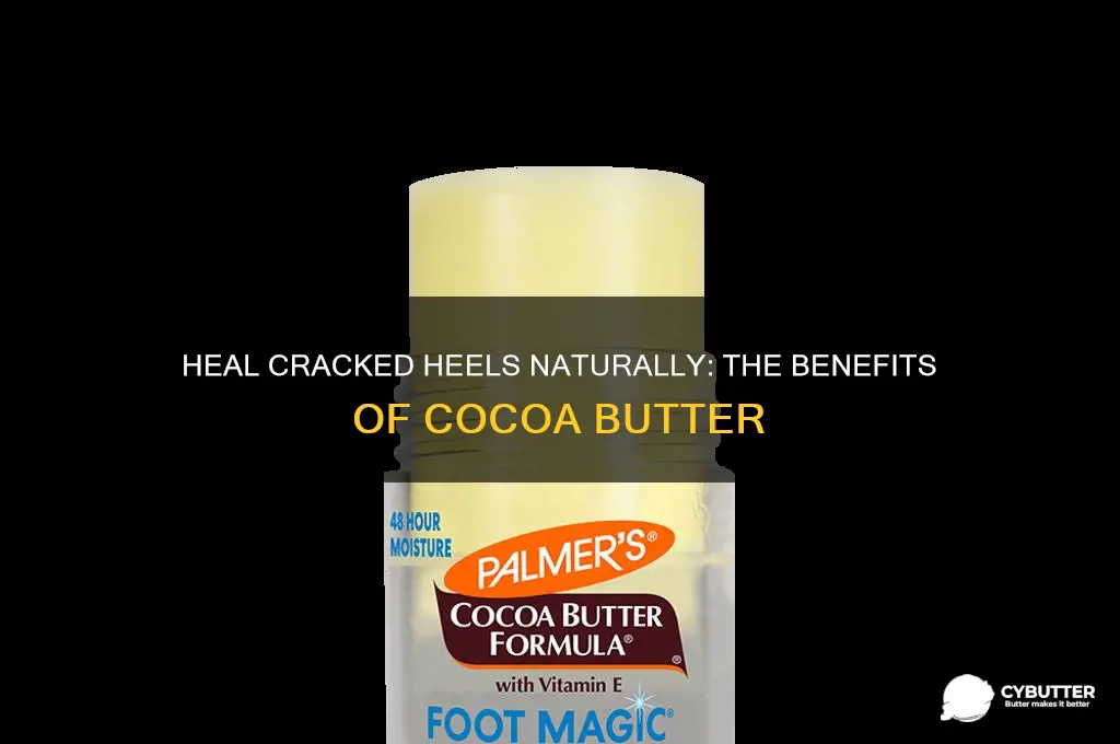 is cocoa butter good for cracked heels