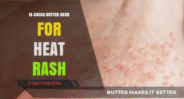 Cocoa Butter for Heat Rash: Benefits, Uses, and Effectiveness Explained