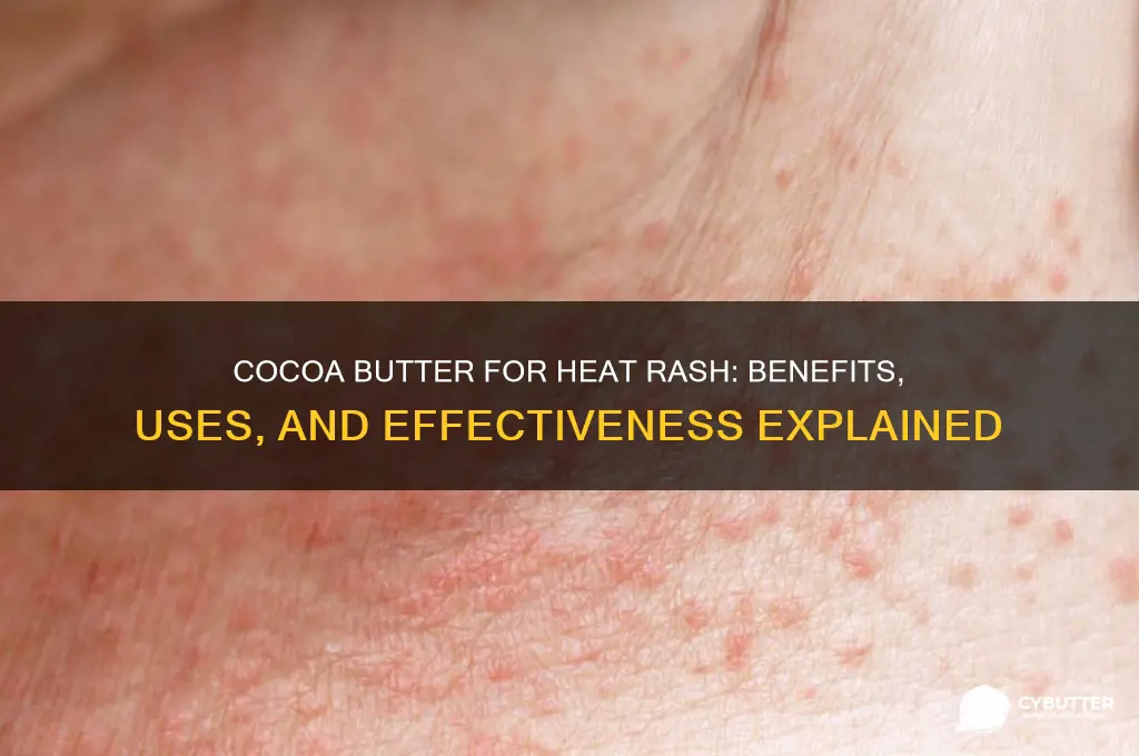 is cocoa butter good for heat rash