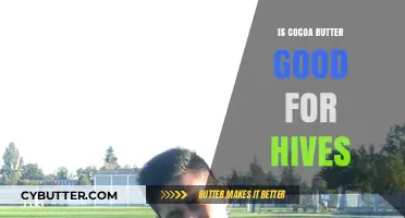 Cocoa Butter for Hives: Natural Relief or Skin Irritant?