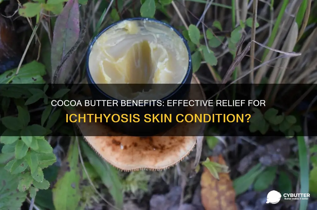 is cocoa butter good for ichthyosis