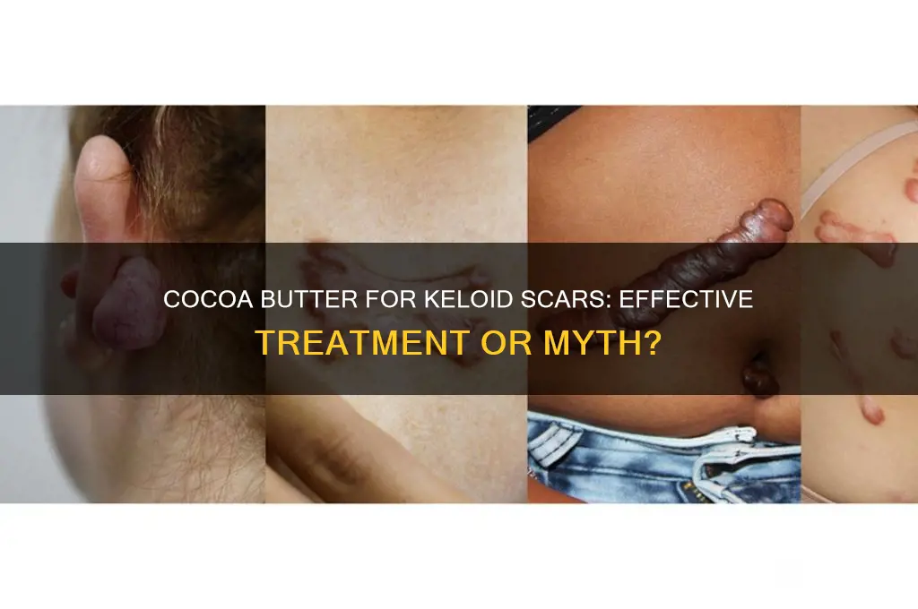 is cocoa butter good for keloid scars