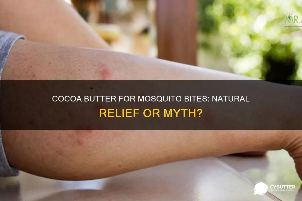 is cocoa butter good for mosquito bites