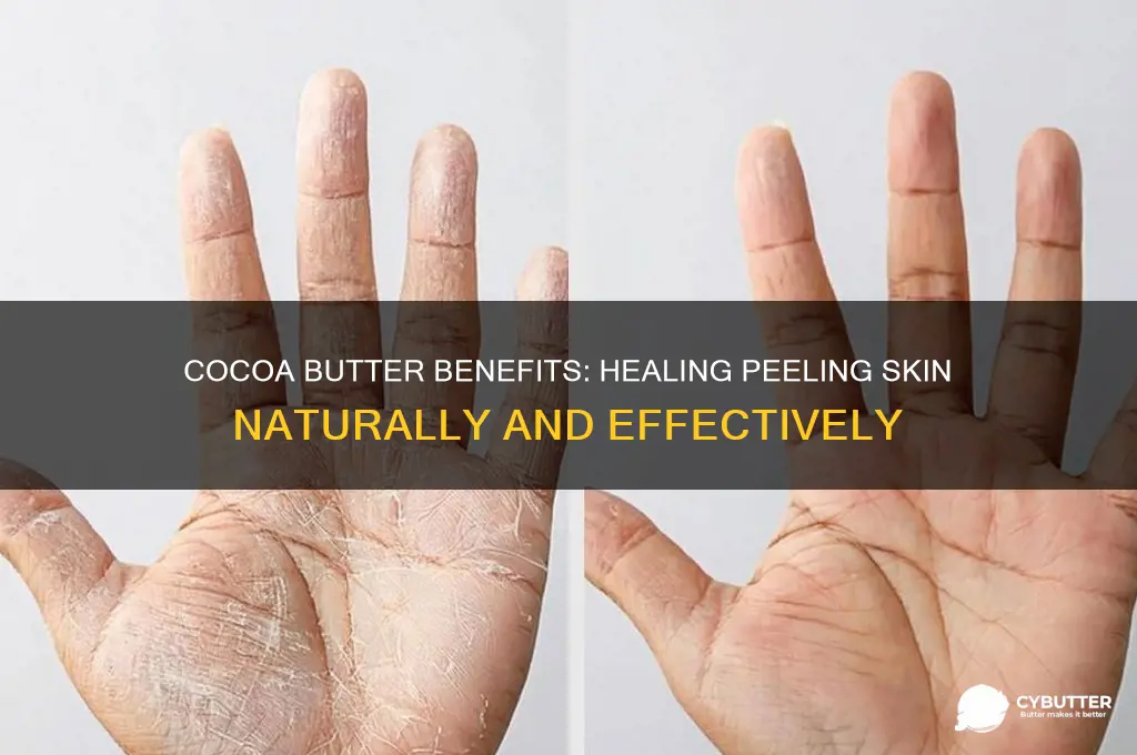 is cocoa butter good for peeling skin